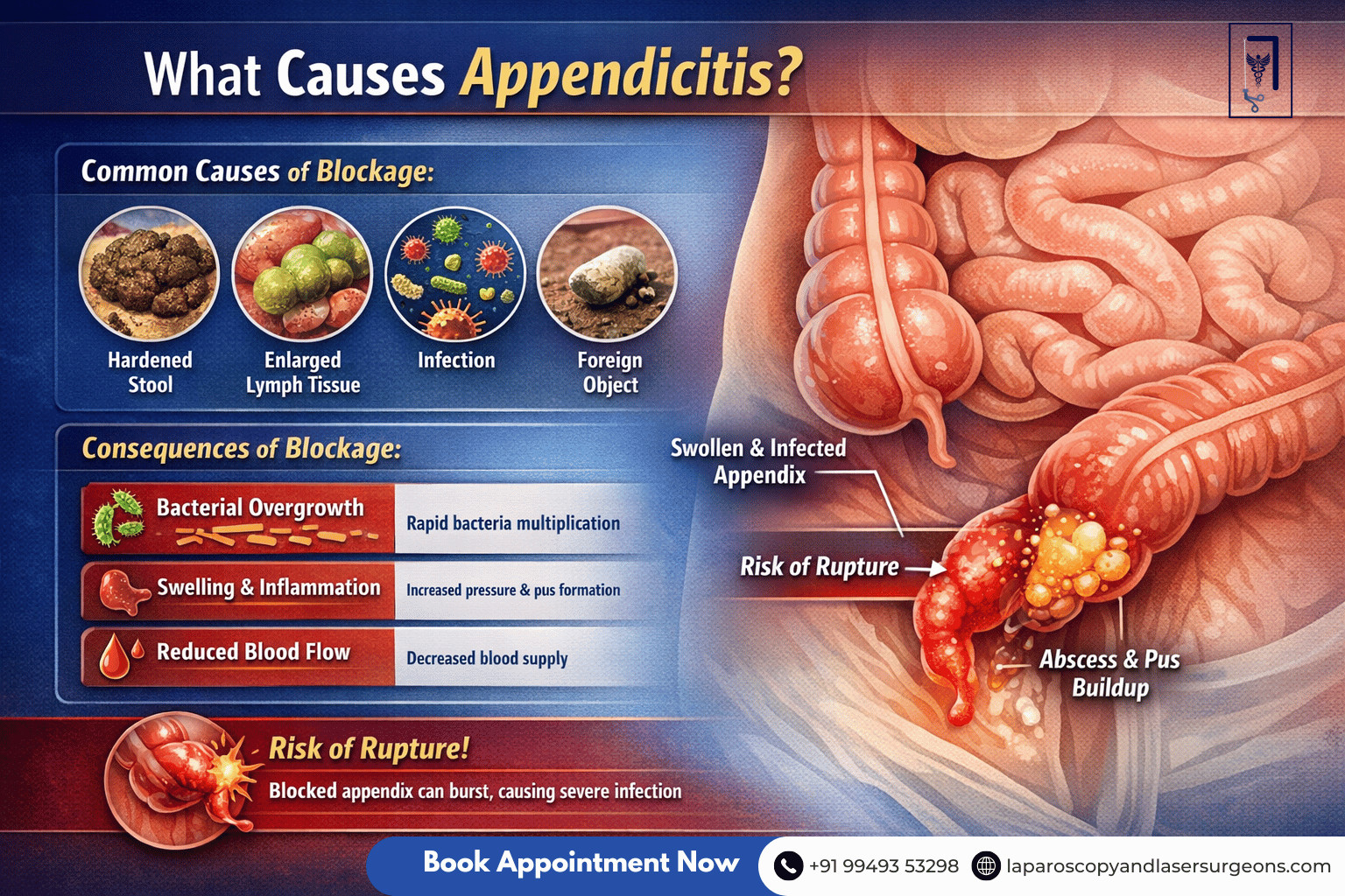 appenditis.blog 1.image 2