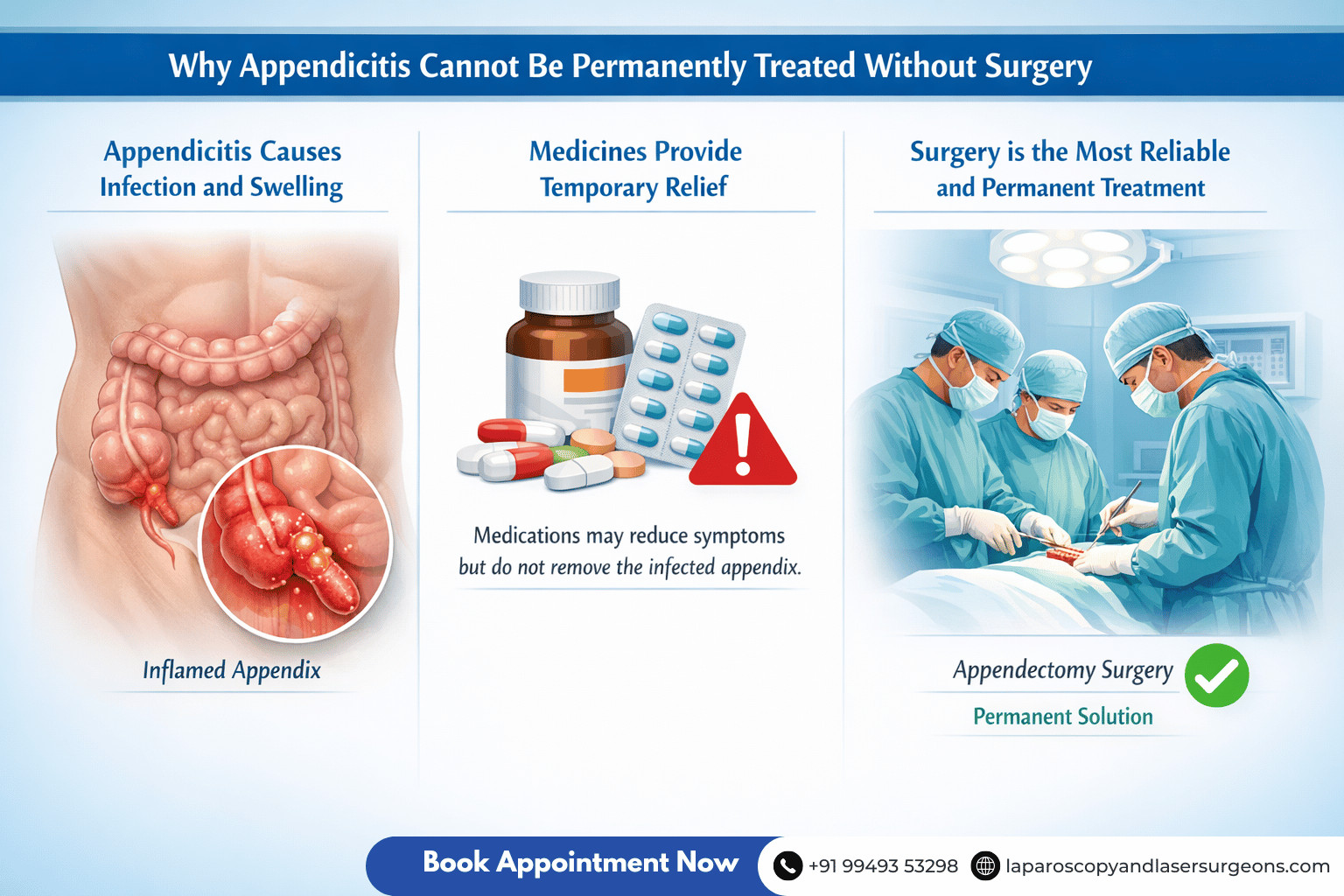 appenditis.blog 4.image 1