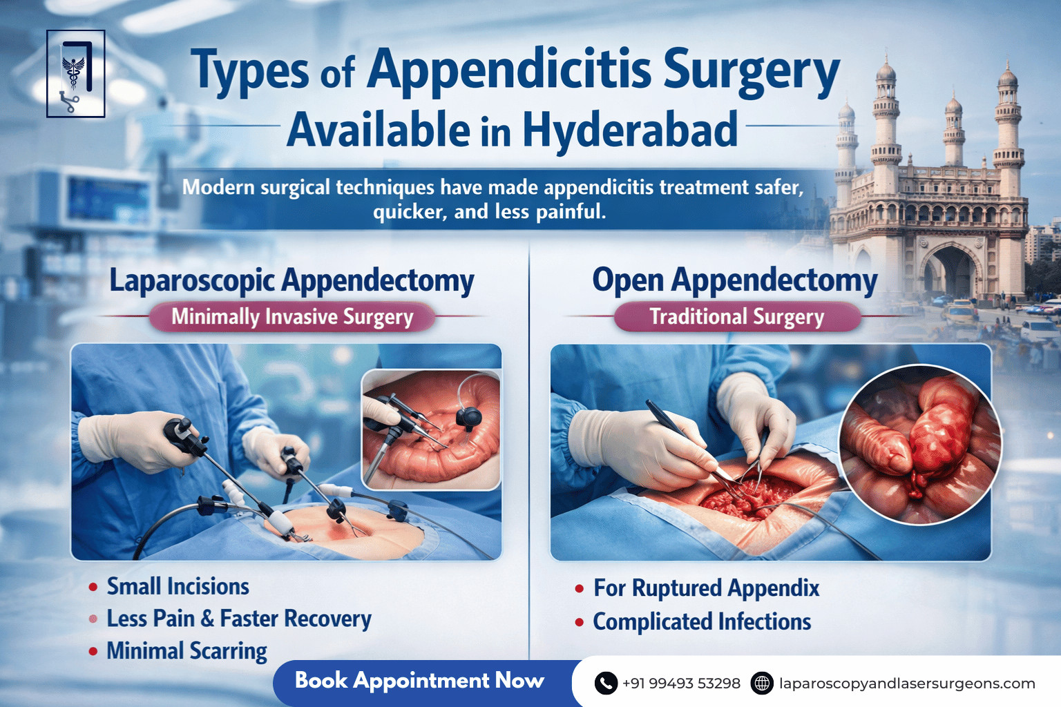 appenditis.blog 4.image 3