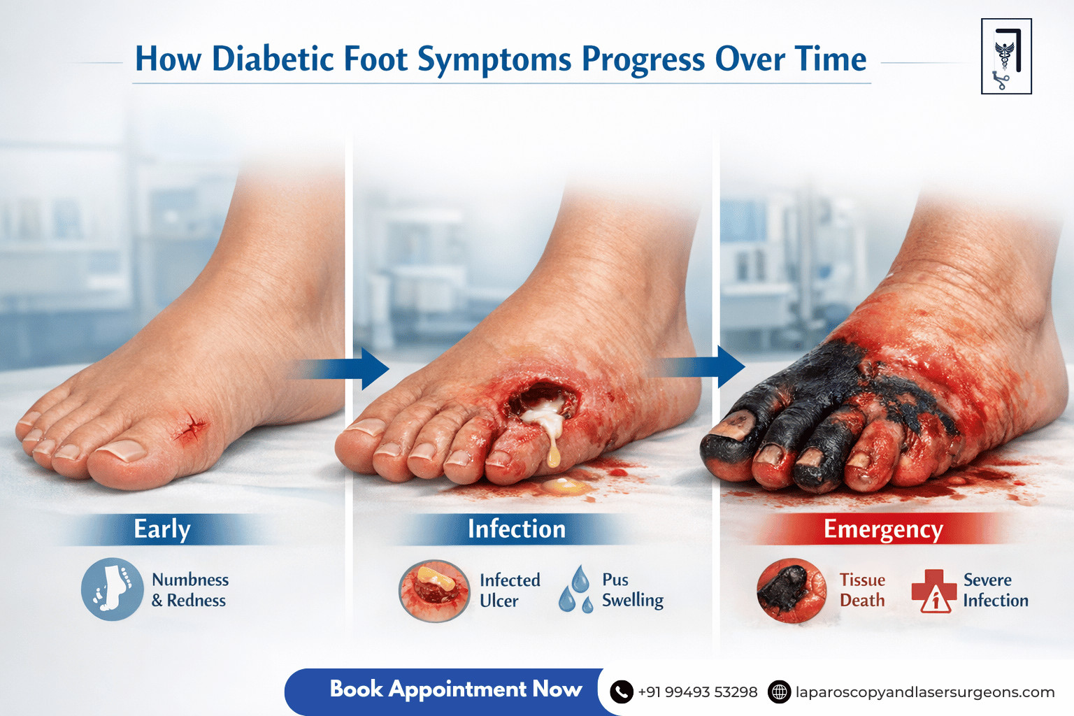 diabetic foot (8)