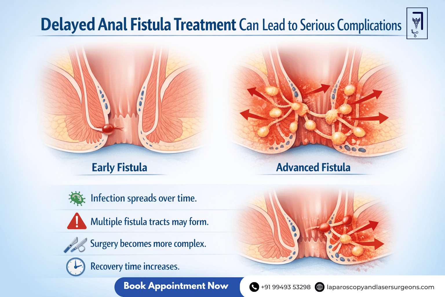 fistula (14)