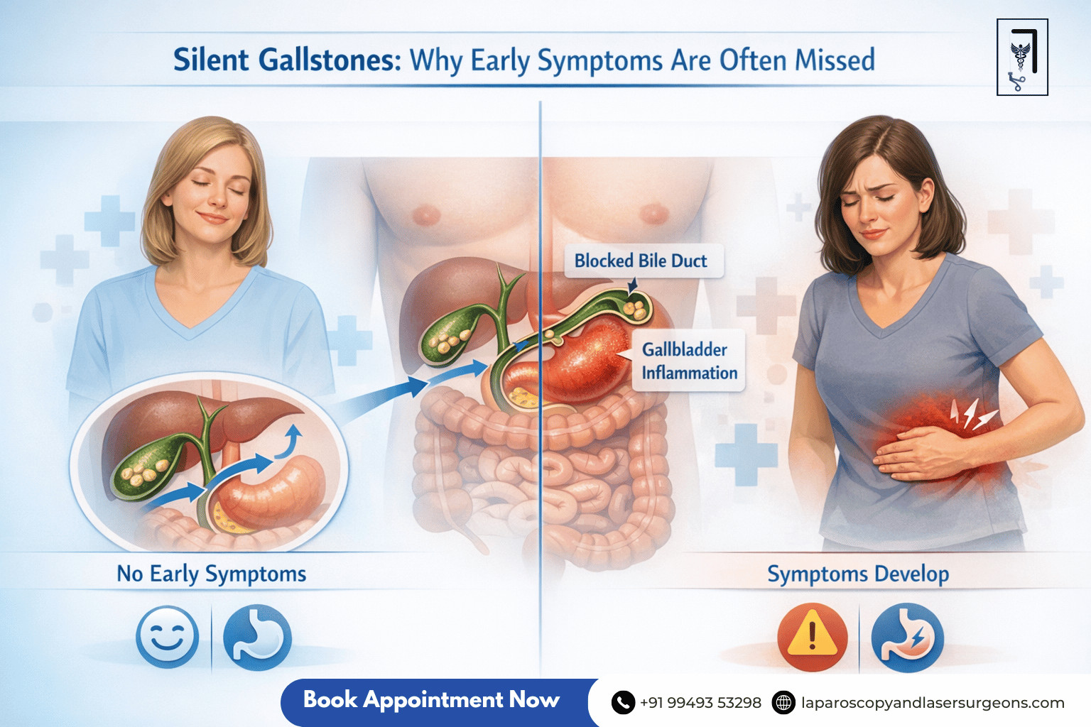 gallbladder stone (10)