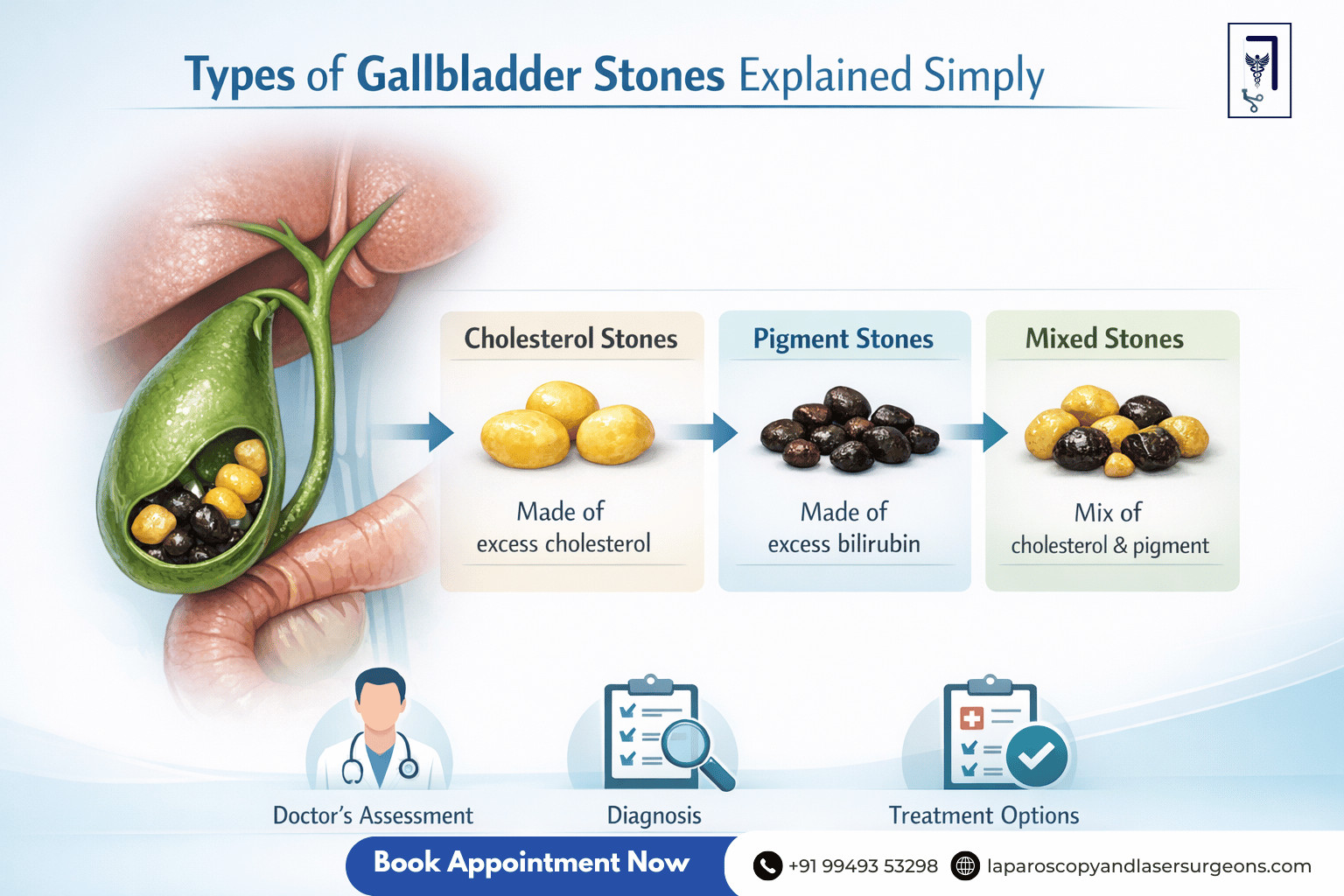 gallbladder stone (12)