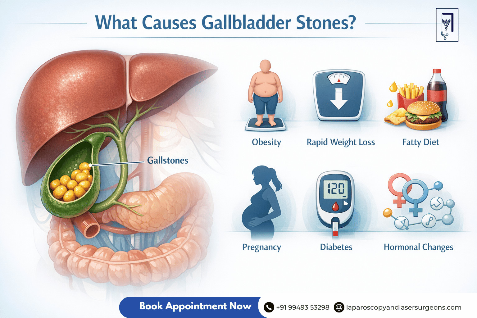 gallbladder stone (2)