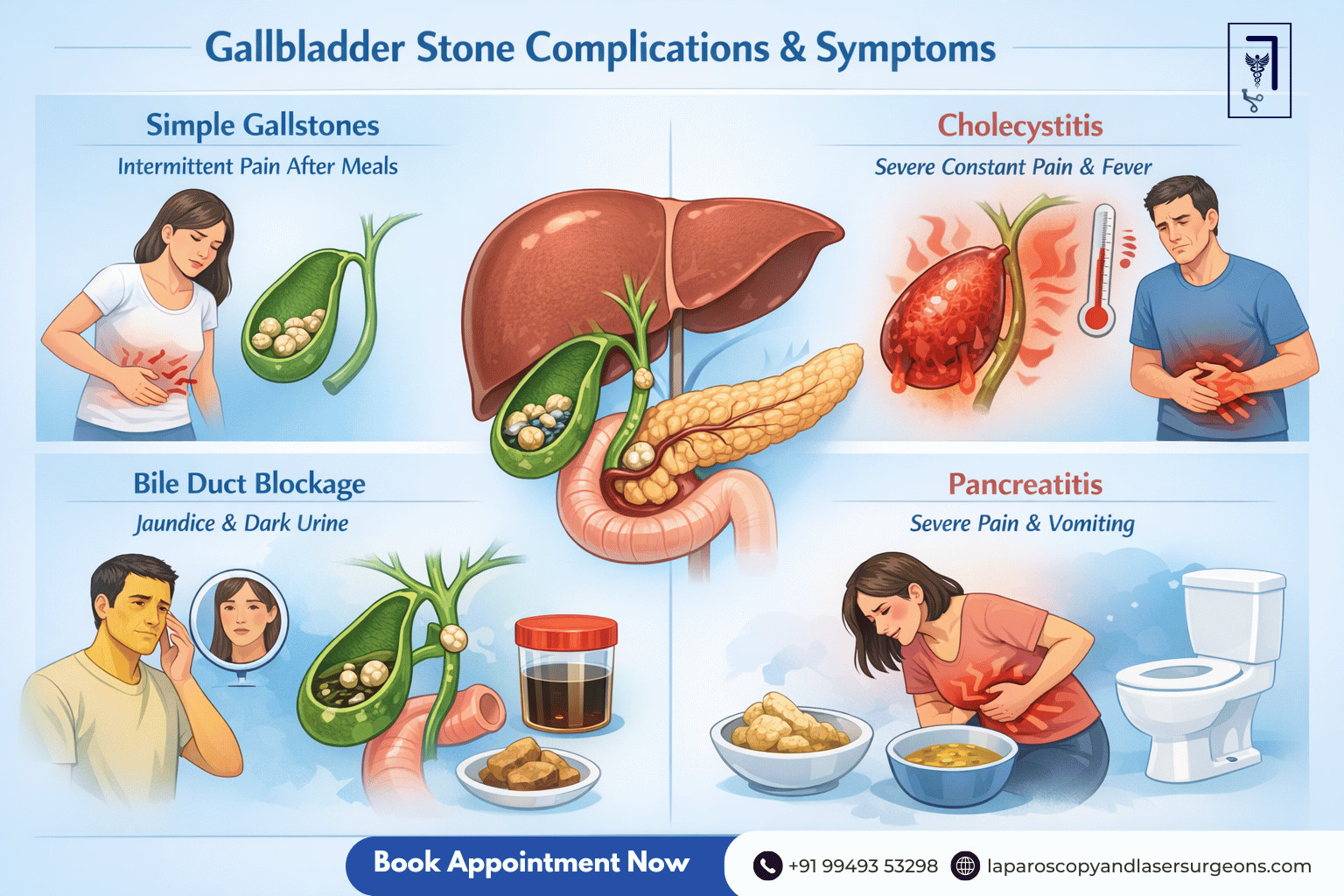 gallbladder stone (8)