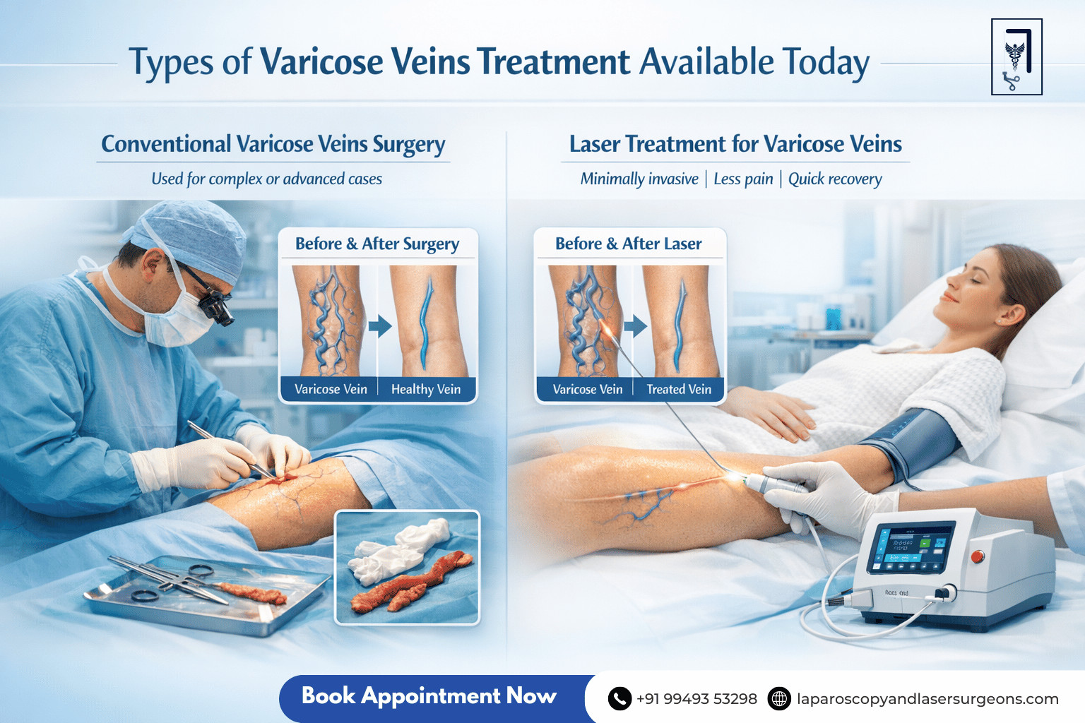 varicose veins (14)